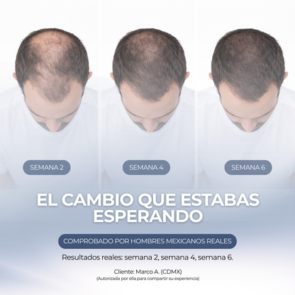 GROWTH MAX™ — Reactiva tu cabello en 6 semanas
