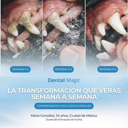 Dental Magic™ - Salud dental sin cepillado ni cirugía