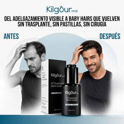 KilgourMD™ | Sérum Capilar para el Adelgazamiento del Cabello