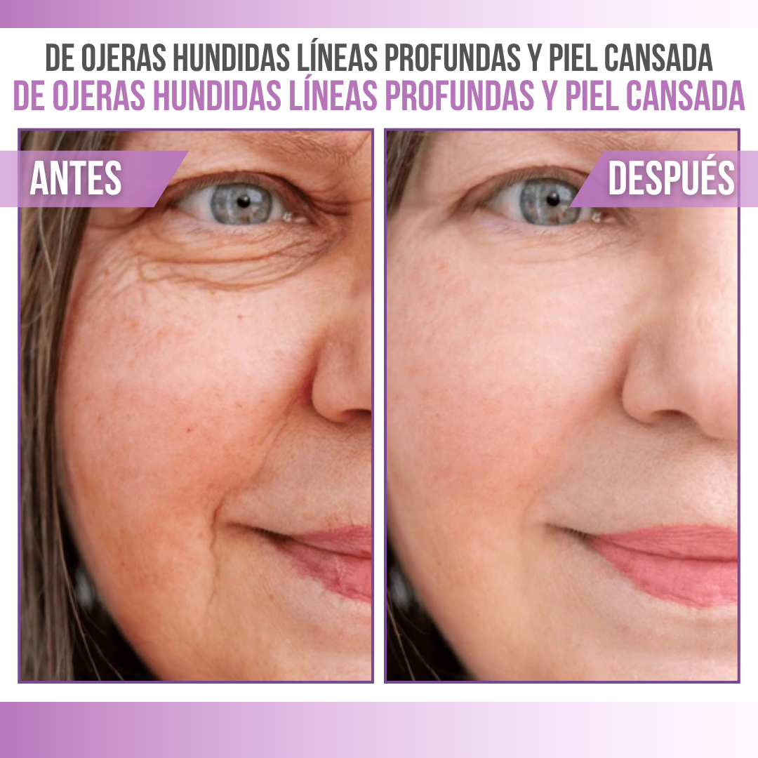 Her+™ Balm Stick | Bálsamo Facial Relleno Dérmico