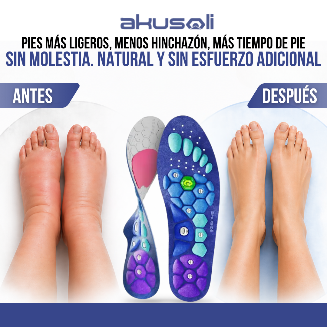 Akusoli™ Plantillas de Acupresión para Pies Hinchados | Reflexología Japonesa + Terapia Magnética.