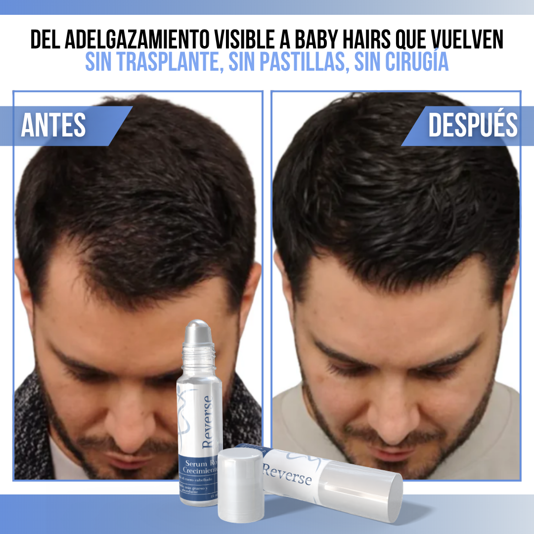 Reverse™ Serum de Crecimiento Capilar