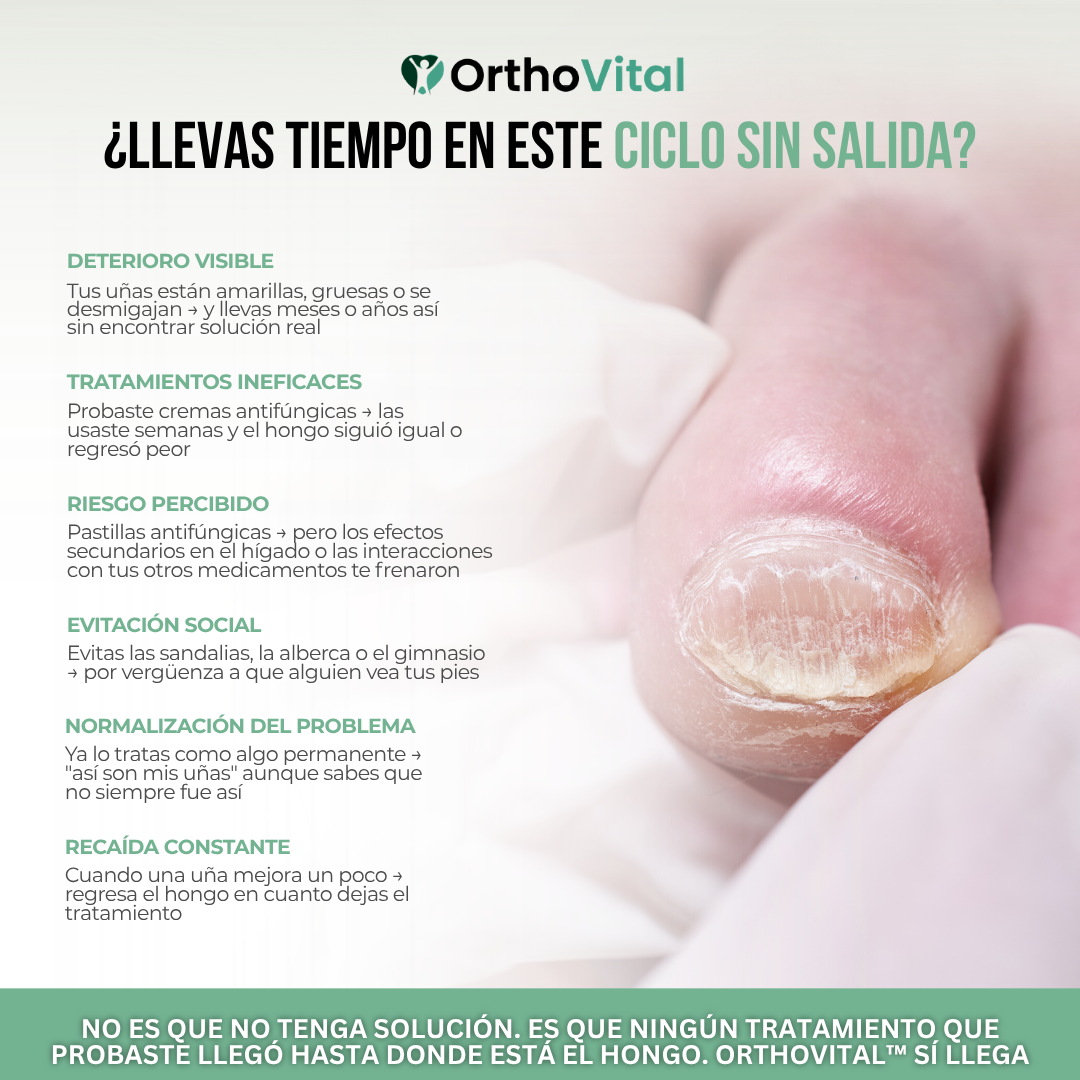 OrthoVital™ Dispositivo de Luz Azul para Hongos en Uñas | Las Cremas No Llegan al Hongo.