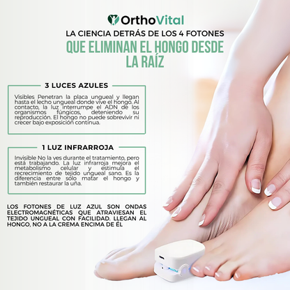 OrthoVital™ Dispositivo de Luz Azul para Hongos en Uñas | Las Cremas No Llegan al Hongo.